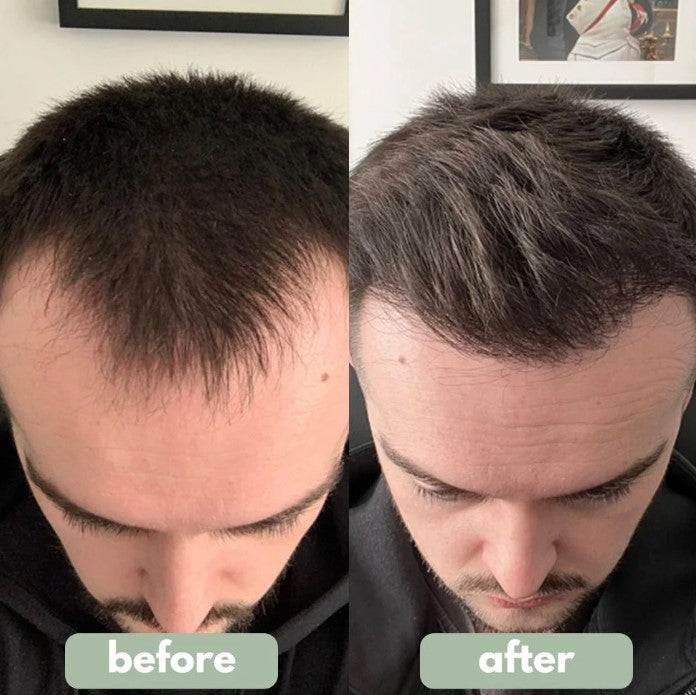 Reverse – Hair Growth Serum