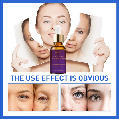 MRUIS Hyaluronic Acid Anti-Aging Essence – 30 mL Premium Face Serum