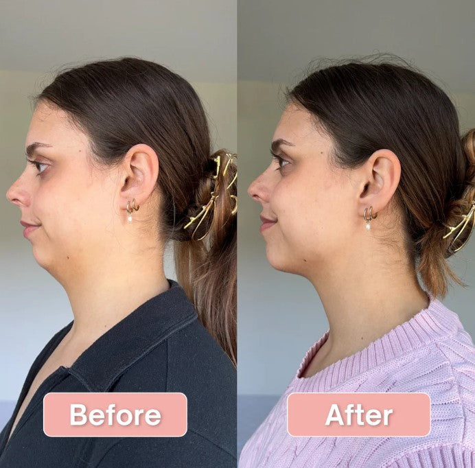 ByHer V-Line Lift Bands