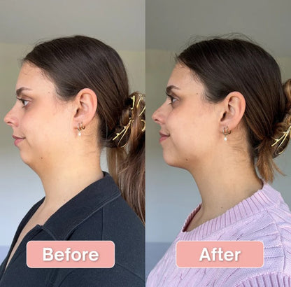 ByHer V-Line Lift Bands